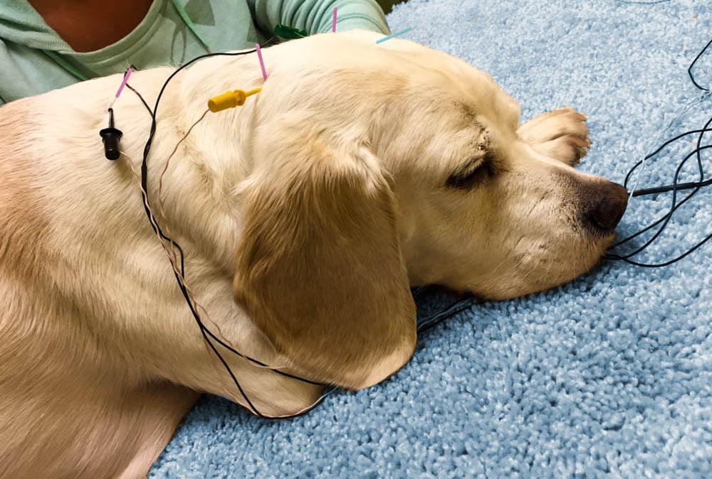 What is Acupuncture?